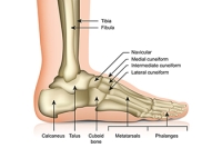 Stress Fractures and Risk Factors